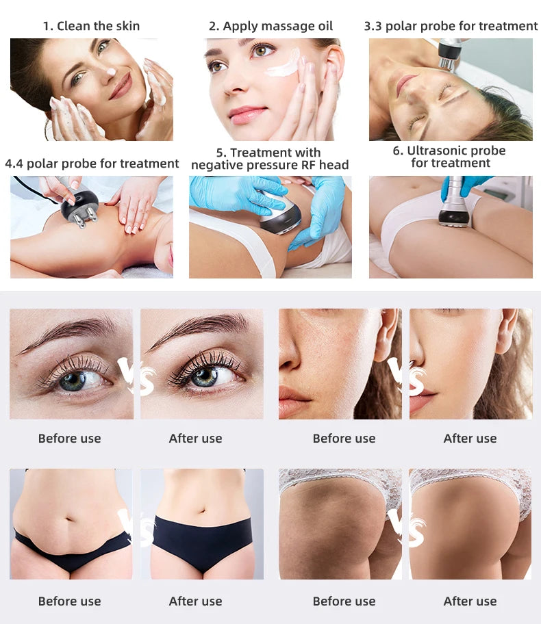 Slimming Machine Facial Massager